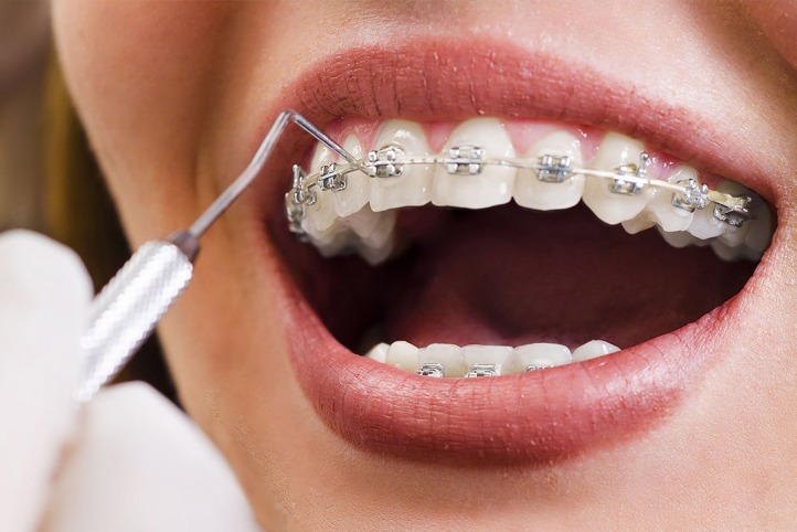 Unlock Your Perfect Smile with an Orthodontist in Adelaide