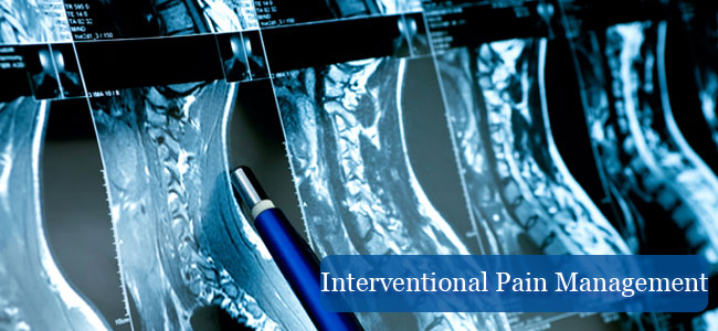 Revolutionizing Pain Relief with Interventional Pain Management